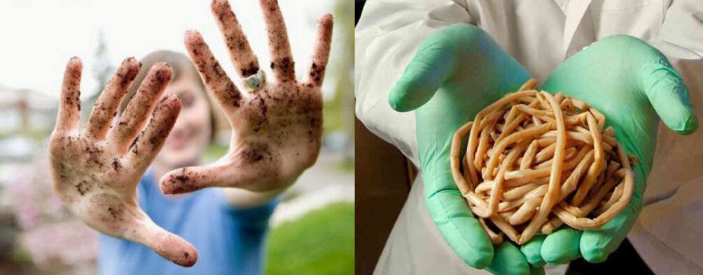 Les parasites peuvent pénétrer dans le corps par des mains sales