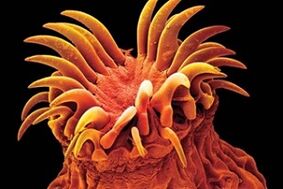 Parasites trématodes chez l'homme