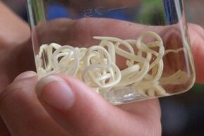 parasites du corps humain