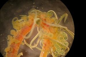 parasites némateux dans le corps humain