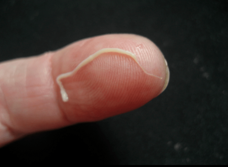 parasite des ascaris du corps humain